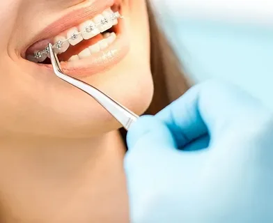 تصویر 1 از خرید پنس دندانپزشکی + قیمت عالی باکیفیت